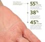 Restore Exam Gloves maxOat+ Nitrile Textured Fingertips M 250Ct OAT6802H by Medline