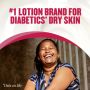 Gold Bond Ultimate Diabetic Dry Skin Lotion 13oz 1Ct OTC053508 by Chattem Inc